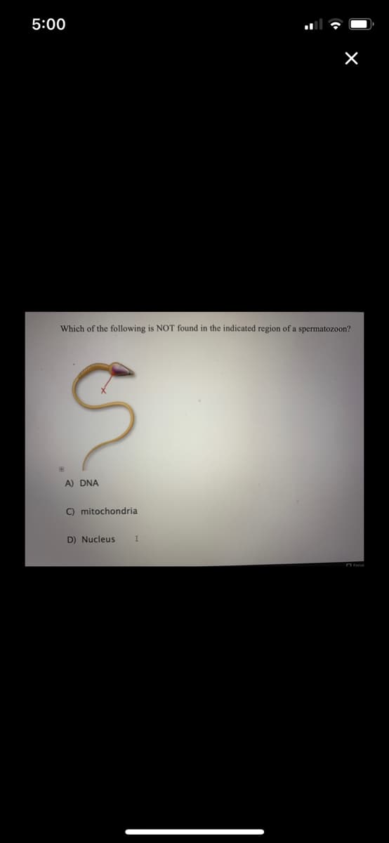 5:00
Which of the following is NOT found in the indicated region of a spermatozoon?
S
A) DNA
C) mitochondrial
D) Nucleus
X
I