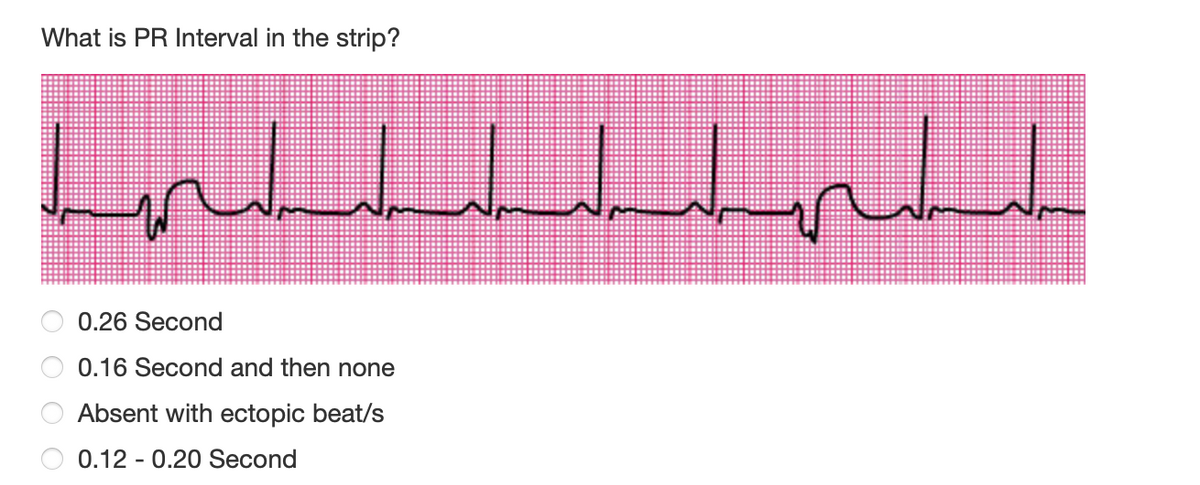 What is PR Interval in the strip?
ال السلس البول
Hot
0.26 Second
0.16 Second and then none
Absent with ectopic beat/s
0.12 0.20 Second
tort