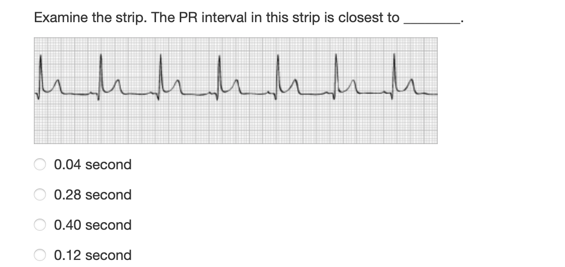Examine the strip. The PR interval in this strip is closest to
миллини
0.04 second
0.28 second
0.40 second
0.12 second