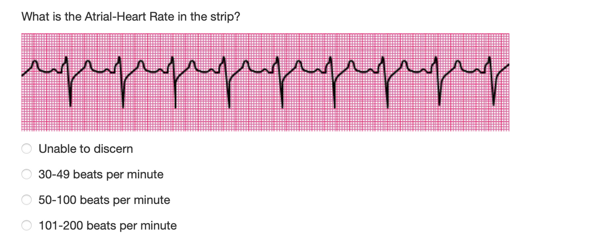 What is the Atrial-Heart Rate in the strip?
пррррррр
Unable to discern
30-49 beats per minute
50-100 beats per minute
101-200 beats per minute