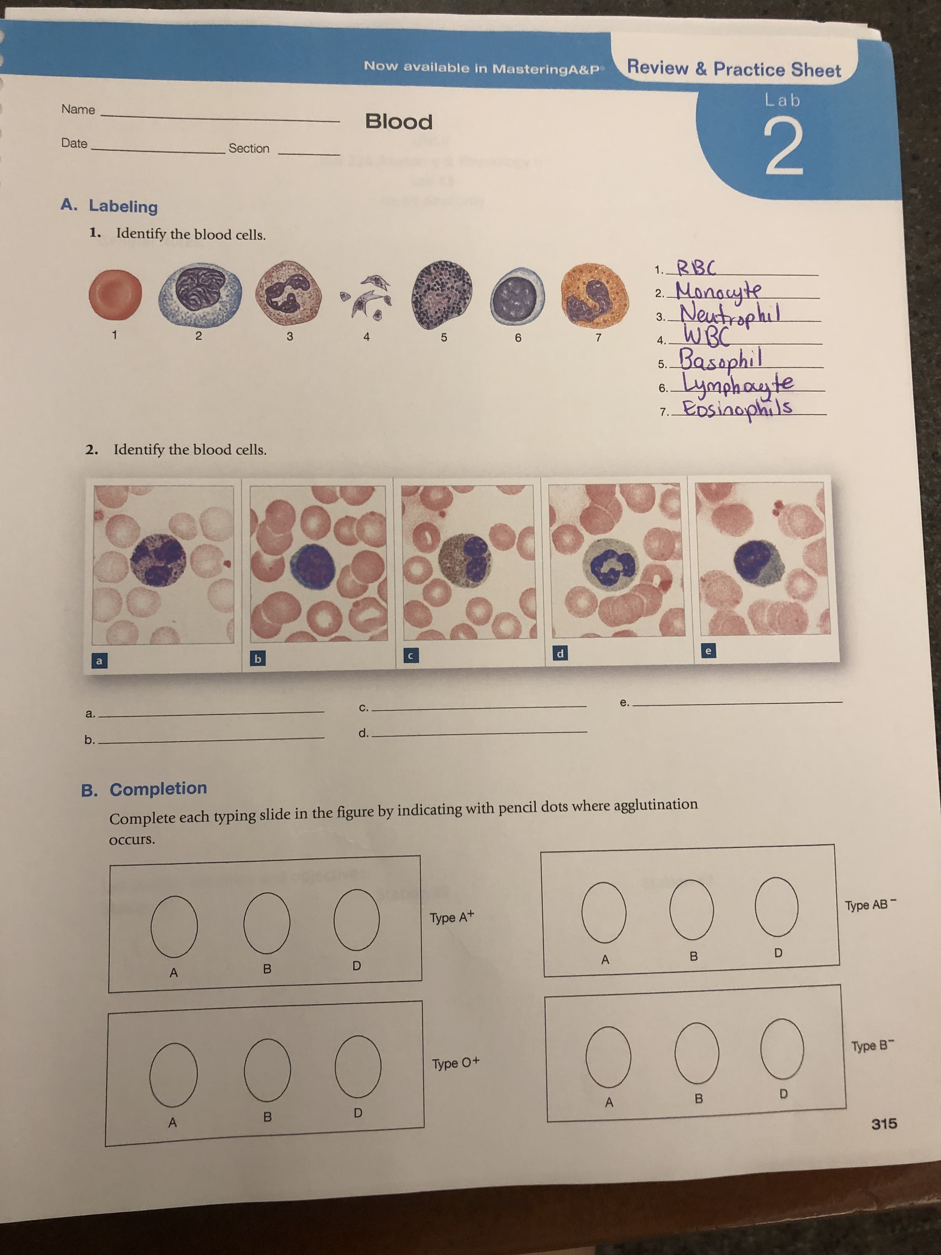 Review&Practice Sheet
Now available in MasteringA&P
Lab
Name
Blood
2
Date
Section
A. Labeling
Identify the blood cells.
1.
RBC
1.
Manayte
Neustrophul
WBC
Basaphil
Lynhayte
PDsinophils
2.
3.
1
2
4
3
7
6
4.
5.
6.
7.
Identify the blood cells.
2.
a
e.
C.
a.
d.
b..
B. Completion
Complete each typing slide in the figure by indicating with pencil dots where agglutination
Occurs.
Туре АB -
Type At
D
B
A
D
B
A
Type B
Type O+
D
B
D
B
A
315
A
LO
