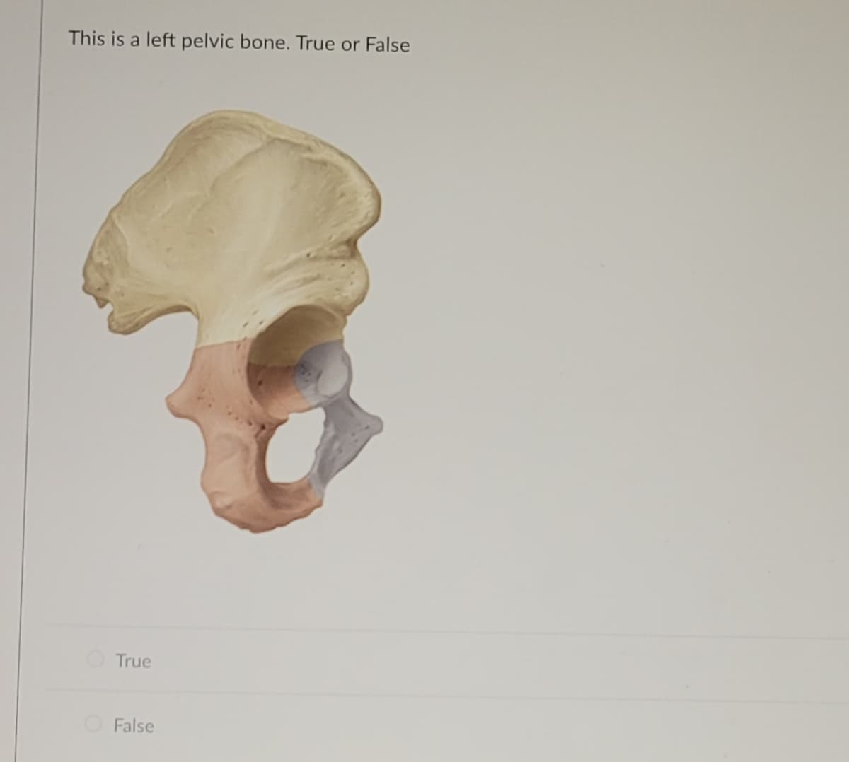 This is a left pelvic bone. True or False
True
False
