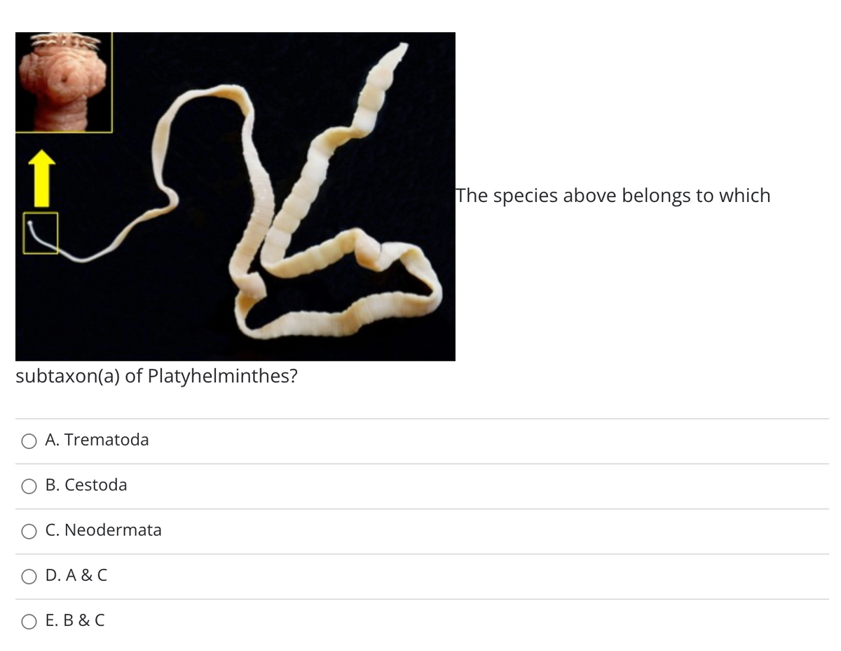 The species above belongs to which
subtaxon(a) of Platyhelminthes?
A. Trematoda
B. Cestoda
C. Neodermata
D. A & C
ОЕ. В & С
