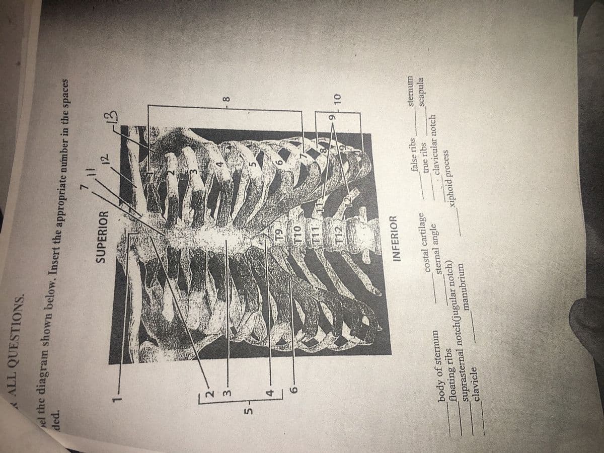 5.
ALL QUESTIONS.
el the diagram shown below. Insert the appropriate number in the spaces
ded.
SUPERIOR
12
13
21
3.
4.
9.
T10
T12
16
OL
INFERIOR
false ribs
sternum
costal cartilage
sternal angle
body of sternum
floating ribs
suprasternal notch(jugular notch)
clavicle
true ribs
clavicular notch
_scapula
xiphoid process
manubrium
