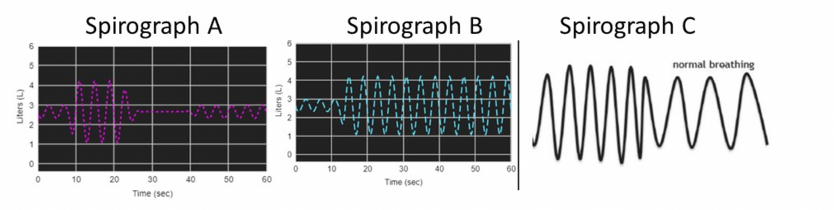 Liters (L)
5
1
0
10
Spirograph A
20
30
Time (sec)
40
50 60
Liters (L)
6
5
0
0
10
Spirograph B
M V
20
30
Time (sec)
40
50
60
Spirograph C
www
normal broathing