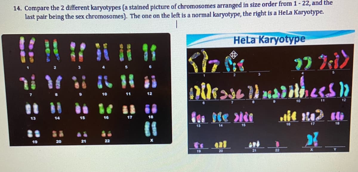 14. Compare the 2 different karyotypes (a stained picture of chromosomes arranged in size order from 1- 22, and the
last pair being the sex chromosomes). The one on the left is a normal karyotype, the right is a HeLa Karyotype.
HeLa Karyotype
10
11
12
10
12
13
14
15
16
17
18
17
18
13
14
15
19
20
21
22
19
20
21
22
