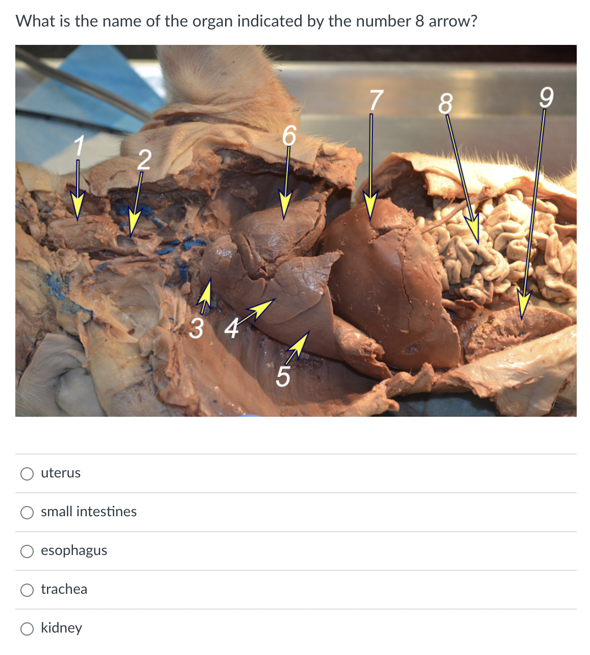 What is the name of the organ indicated by the number 8 arrow?
uterus
small intestines
esophagus
trachea
2
kidney
34
6
5
7
8
9