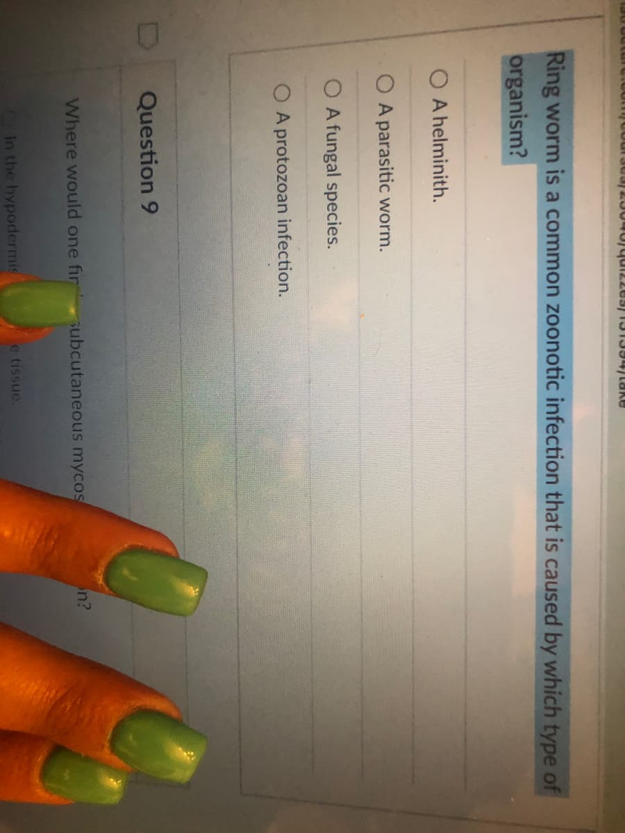 Ring worm is a common zoonotic infection that is caused by which type of
organism?
A helminith.
A parasitic worm.
O A fungal species.
O A protozoan infection.
Question 9
Where would one fin ubcutaneous mycos
n?
In the hypodermis
e tissue.
