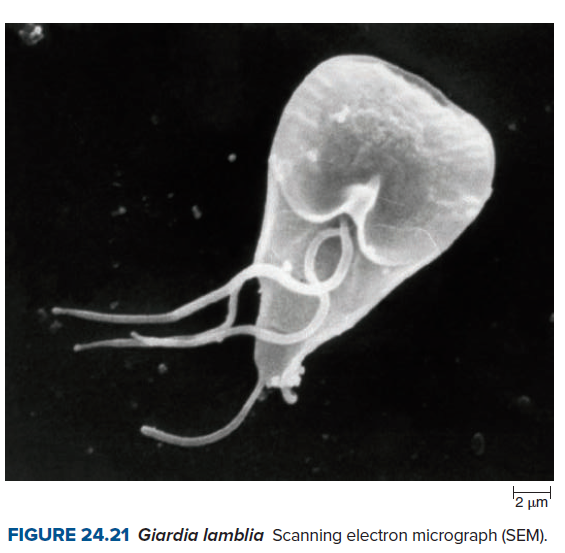 '2 µm
FIGURE 24.21 Giardia lamblia Scanning electron micrograph (SEM).
