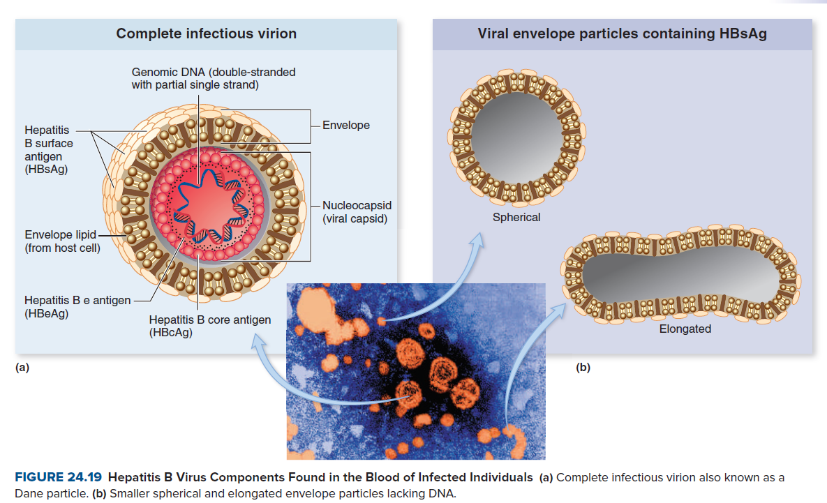 Complete infectious virion
Viral envelope particles containing HBsAg
Genomic DNA (double-stranded
with partial single strand)
-Envelope
Нерatitis
B surface
antigen
(HBSAG)
– Nucleocapsid
(viral capsid)
Spherical
Envelope lipid-
(from host cell)
EE
Hepatitis Be antigen
(HBEA9)
Hepatitis B core antigen
(НВСAg)
Elongated
(a)
(b)
FIGURE 24.19 Hepatitis B Virus Components Found in the Blood of Infected Individuals (a) Complete infectious virion also known as a
Dane particle. (b) Smaller spherical and elongated envelope particles lacking DNA.
