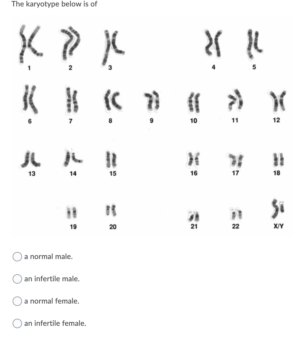 The karyotype below is of
5
自
7
8
9
10
11
12
%3D
%3D
13
14
15
16
17
18
19
20
22
X/Y
a normal male
an infertile male.
a normal female.
O an infertile female.
21
