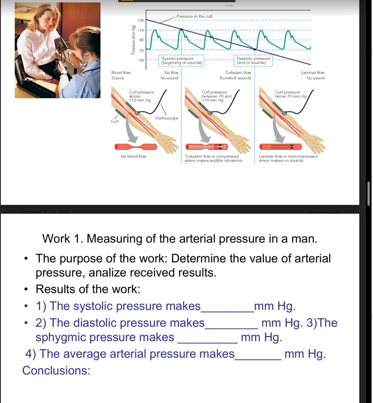 Posted 3:02 PM
●
●
●
●
Blood flow:
Sound:
Cuff
Pressure (mm Hg)
130
110
90
70
50
Cuff pressure
above
110 mm Hg
No blood flow
Pressure in the cuff
Systolic pressure
(beginning of sounds)
No flow
No sound.
Stethoscope
^^^
Diastolic pressure
(end of sounds)
Turbulent flow
Korotkoff sounds
Cuff pressure
between 70 and
110 mm Hg
Turbulent flow in compressed
artery makes audible vibrations
1) The systolic pressure makes
2) The diastolic pressure makes
sphygmic pressure makes
4) The average arterial pressure makes_
Conclusions:
Cuff pressure
below 70 mm Hg,
Work 1. Measuring of the arterial pressure in a man.
The purpose of the work: Determine the value of arterial
pressure, analize received results.
Results of the work:
Laminar flow
No sound
Laminar flow in noncompressed
artery makes no sounds
mm Hg.
mm Hg. 3)The
mm Hg.
mm Hg.