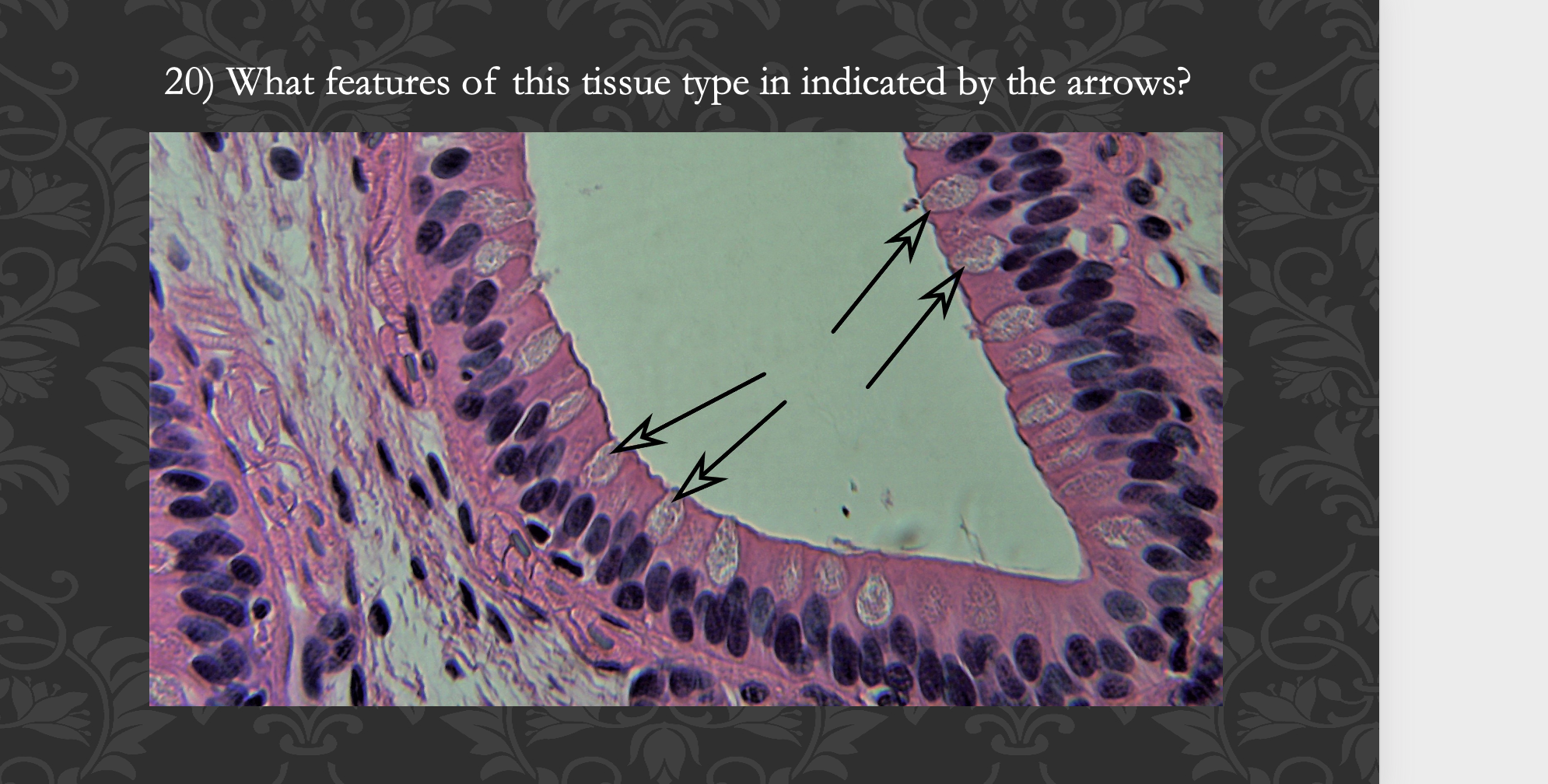 20) What features of this tissue type in indicated by the arrows?