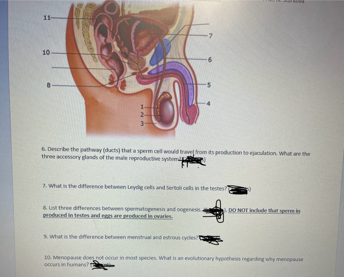 11-
10
8
36
3
7
8. List three differences between spermatogenesis and oogenesis..
produced in testes and eggs are produced in ovaries.
-6
9. What is the difference between menstrual and estrous cycles?
5
6. Describe the pathway (ducts) that a sperm cell would travel from its production to ejaculation. What are the
three accessory glands of the male reproductive system212
7. What is the difference between Leydig cells and Sertoli cells in the testes?
Stai kuva
DO NOT include that sperm in
10. Menopause does not occur in most species. What is an evolutionary hypothesis regarding why menopause
occurs in humans?