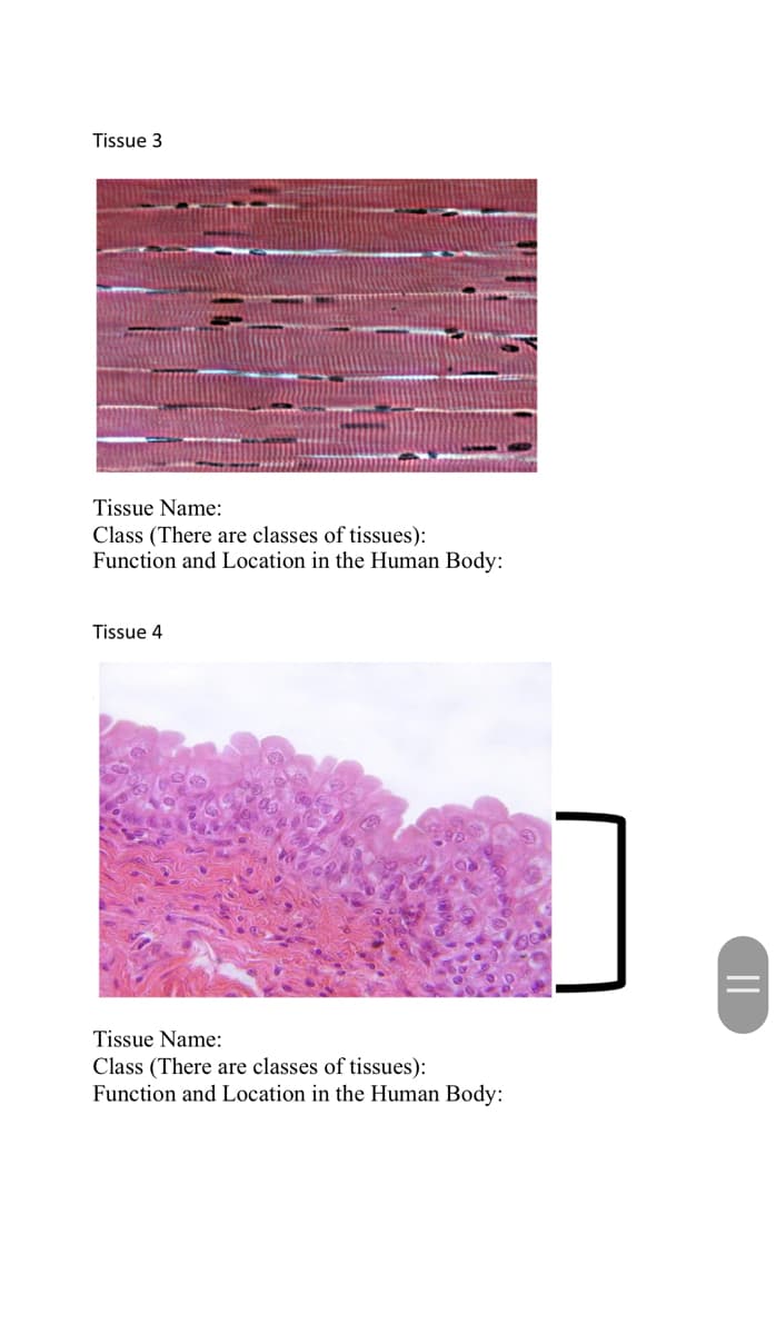Tissue 3
Tissue Name:
Class (There are classes of tissues):
Function and Location in the Human Body:
Tissue 4
Tissue Name:
Class (There are classes of tissues):
Function and Location in the Human Body:
||