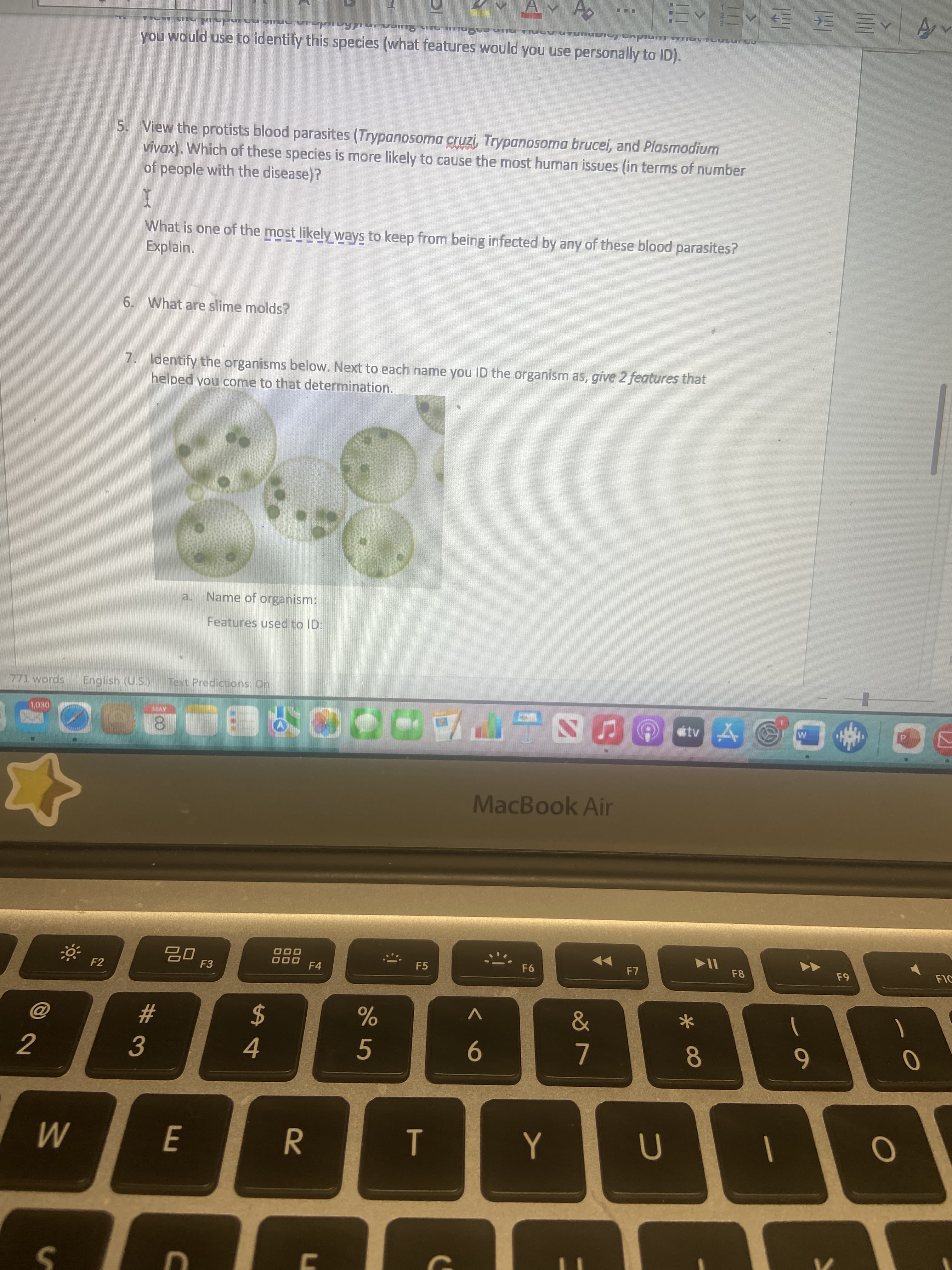 * 0O
100
v Ao
you would use to identify this species (what features would you use personally to ID).
^タヘ三 臣ヘ=
5. View the protists blood parasites (Trypanosoma cruzi, Trypanosoma brucei, and Plasmodium
vivax). Which of these species is more likely to cause the most human issues (in terms of number
of people with the disease)?
What is one of the most likely ways to keep from being infected by any of these blood parasites?
Explain.
6. What are slime molds?
7. Identify the organisms below. Next to each name you ID the organism as, give 2 features that
helped you come to that determination.
Name of organism:
a.
Features used to ID:
771 words
English (U.S.)
Text Predictions: On
DEOL
8.
ca上門后
MacBook Air
71
64
000
F4
F5
F6
F8
F2
F3
23
2$
5.
6.
4.
R.
