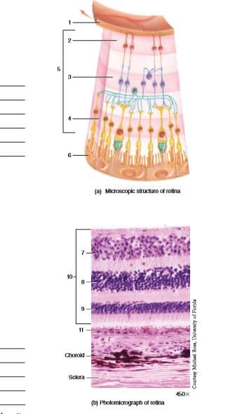 3-
6-
(a) Microscopic structuro of rotina
11
Chorold
Sckera
450x
(b) Pholomicrograph of retina
vpuoa jo kupuanu 'oy pags auno
