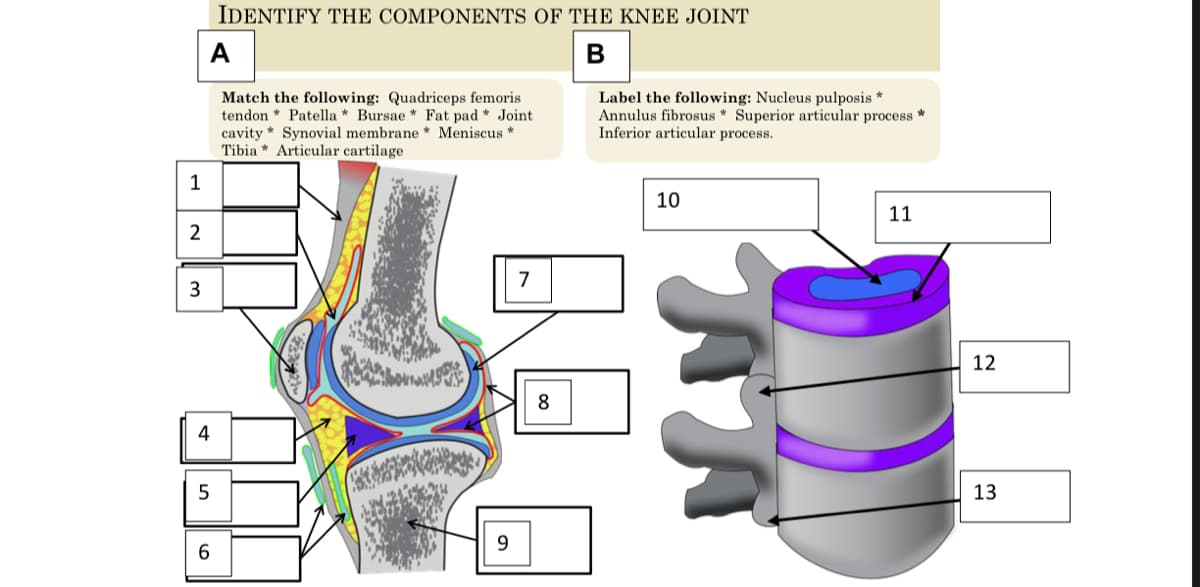 IDENTIFY THE COMPONENTS OF THE KNEE JOINT
A
Match the following: Quadriceps femoris
tendon * Patella * Bursae * Fat pad * Joint
cavity * Synovial membrane * Meniscus *
Tibia * Articular cartilage
Label the following: Nucleus pulposis *
Annulus fibrosus * Superior articular process
Inferior articular process.
10
11
2
7
12
8
4
13
9.
