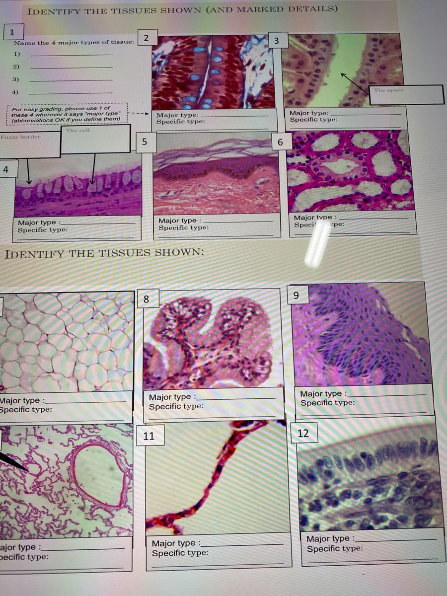 IDENTIFY THE TISSUES SHOWN (AND MARKED DETAILS)
LJA
2
Name the 4 major types of tissue:
3
1)
2)
3)
The space
4)
For easy grading, please use 1 of
these 4 wherever it says "major type"
: (abbreviations OK if you define them)
Major type:
Major type:
Specific type:
Specific type:
--------------
The cell
Fuzzy border
5
4
Major type
Specific type:
Major type
Specific type:
Major tvpe:
Speci
уре:
IDENTIFY THE TISSUES SHOWN:
8.
Major type :
Specific type:
Major type :_
Specific type:
Major type :
Specific type:
11
12
ajor type :
pecific type:
Major type :
Specific type:
Major type :
Specific type:
