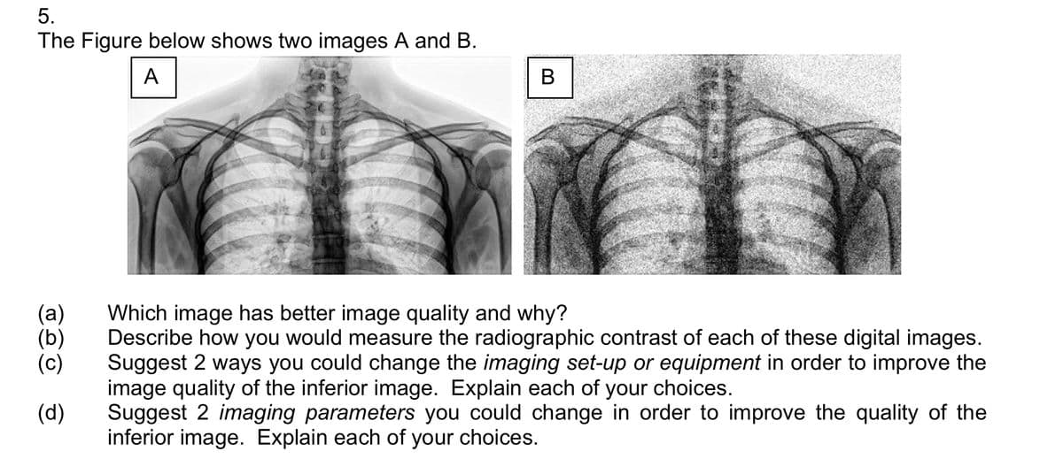 5.
The Figure below shows two images A and B.
A
B
(a)
Which image has better image quality and why?
(b)
(c)
Describe how you would measure the radiographic contrast of each of these digital images.
Suggest 2 ways you could change the imaging set-up or equipment in order to improve the
image quality of the inferior image. Explain each of your choices.
(d)
Suggest 2 imaging parameters you could change in order to improve the quality of the
inferior image. Explain each of your choices.