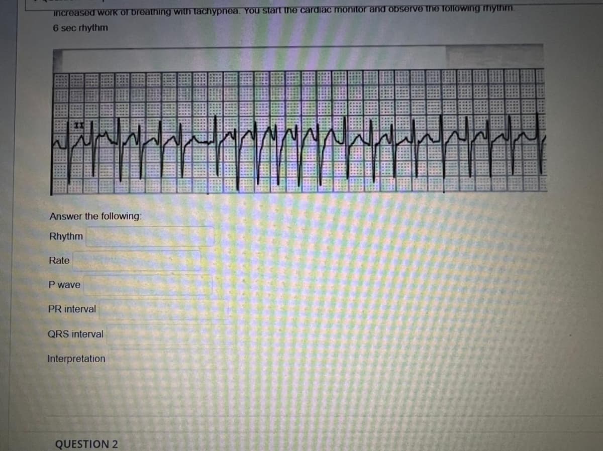 increased work of breathing wilh lachypnea. You start the cardiac monitor and observe the Tollowing mytim.
6 sec rhythm
Answer the following:
Rhythm
Rate
P wave
PR interval
QRS interval
Interpretation
QUESTION 2
