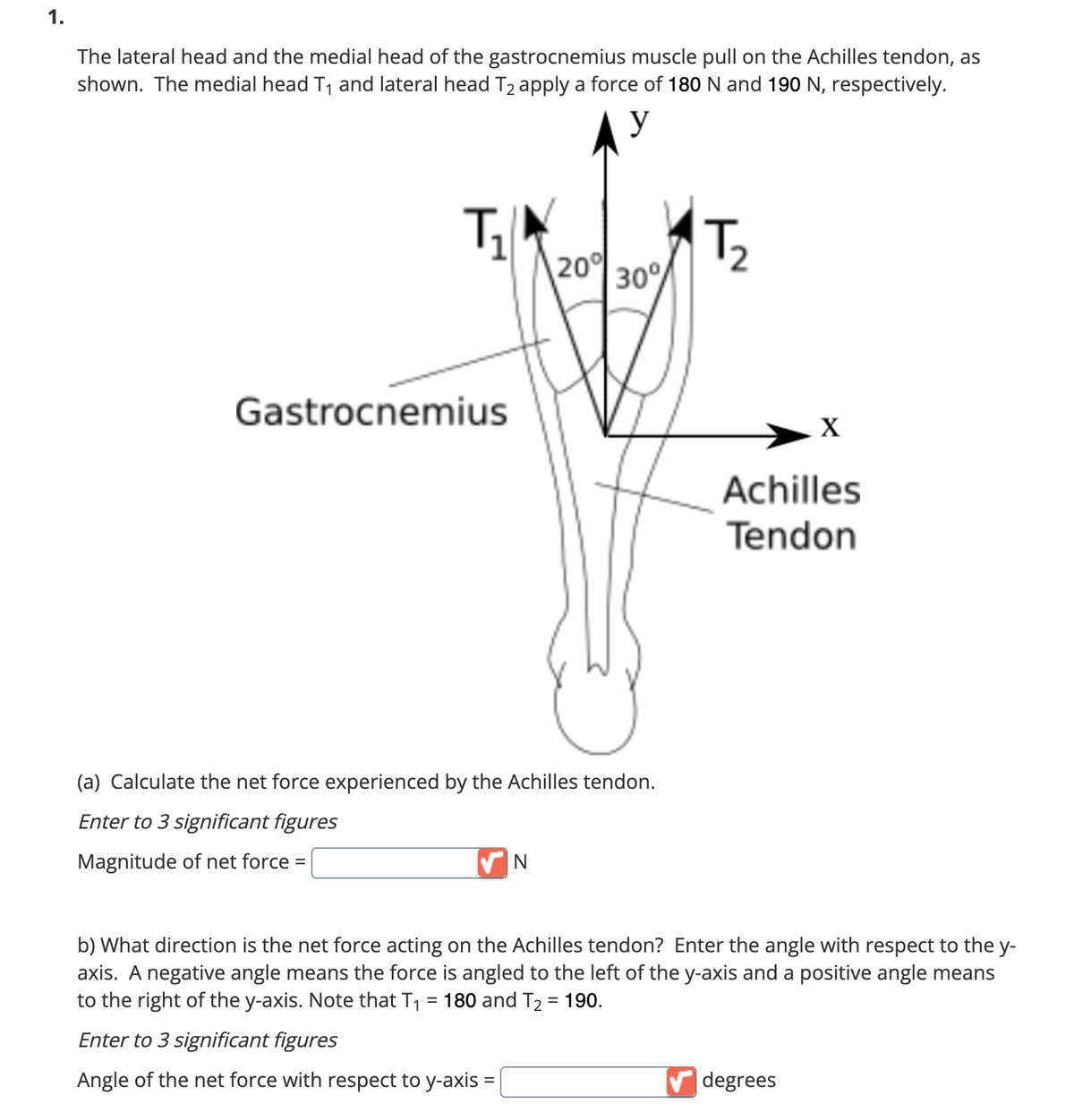 1.
The lateral head and the medial head of the gastrocnemius muscle pull on the Achilles tendon, as
shown. The medial head T₁ and lateral head T₂ apply a force of 180 N and 190 N, respectively.
y
T₁
Gastrocnemius
20°
✔N
30°
(a) Calculate the net force experienced by the Achilles tendon.
Enter to 3 significant figures
Magnitude of net force =
T₂
X
Achilles
Tendon
b) What direction is the net force acting on the Achilles tendon? Enter the angle with respect to the y-
axis. A negative angle means the force is angled to the left of the y-axis and a positive angle means
to the right of the y-axis. Note that T₁ = 180 and T₂ = 190.
Enter to 3 significant figures
Angle of the net force with respect to y-axis =
✔degrees