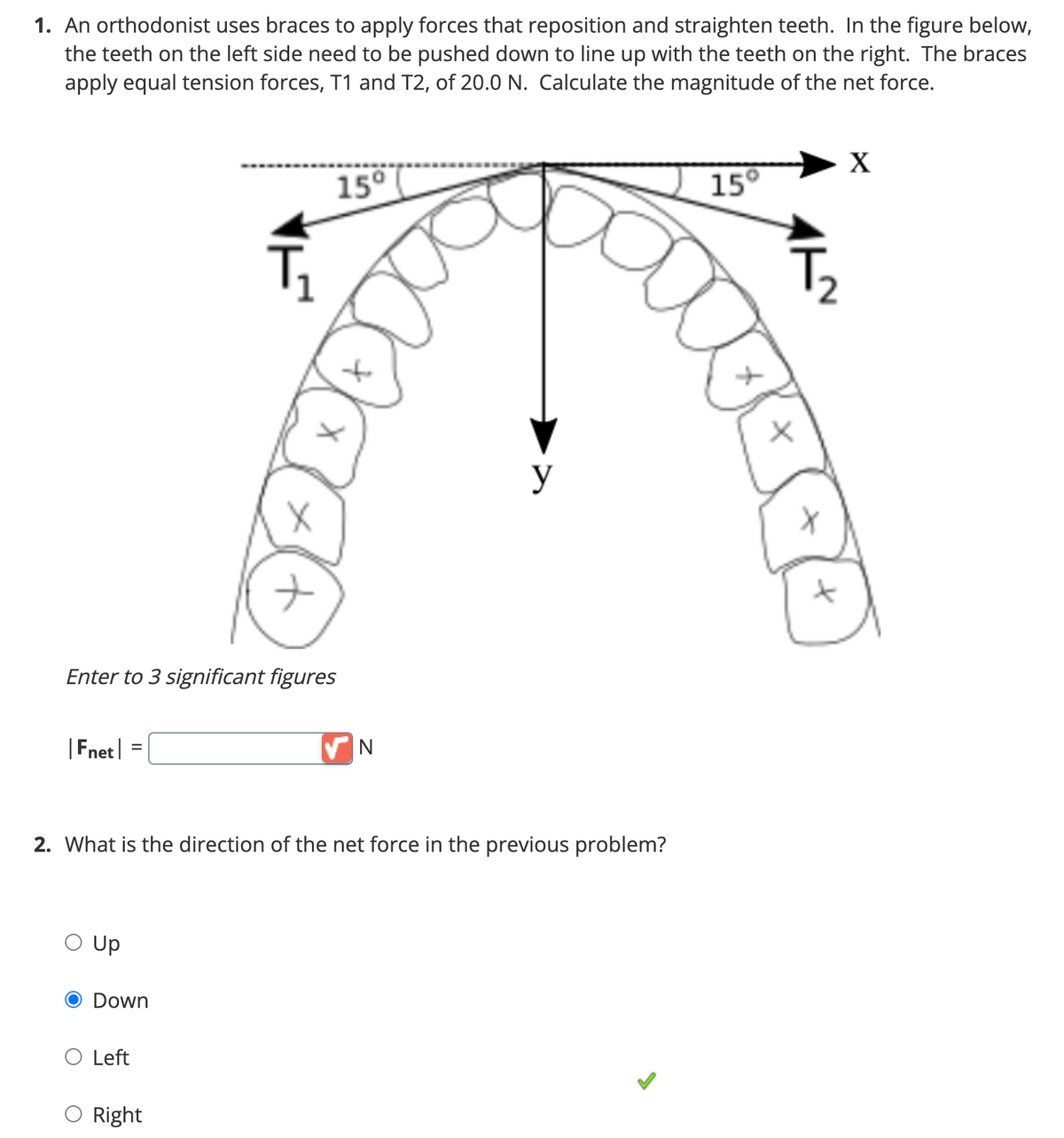 1. An orthodonist uses braces to apply forces that reposition and straighten teeth. In the figure below,
the teeth on the left side need to be pushed down to line up with the teeth on the right. The braces
apply equal tension forces, T1 and T2, of 20.0 N. Calculate the magnitude of the net force.
|Fnet
Enter to 3 significant figures
O UP
Down
X
ナ
O Left
15⁰
2. What is the direction of the net force in the previous problem?
Right
✔N
y
15°
X