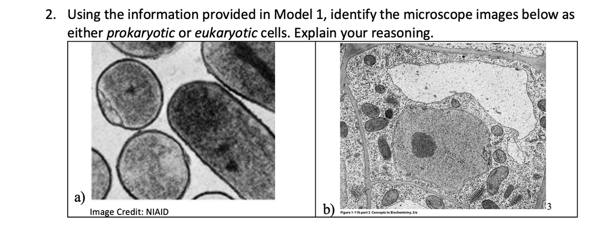 2. Using the information provided in Model 1, identify the microscope images below as
either prokaryotic or eukaryotic cells. Explain your reasoning.
a)
Image Credit: NIAID
b)
Figure 1-11b part 2 Concepts in Biochemistry, 3/e
3