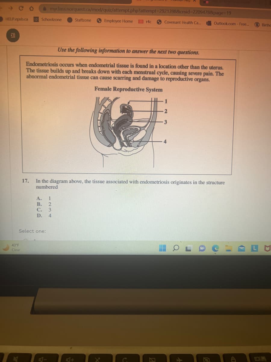 -CO
HELP.epsb.ca
43°F
Clear
Schoolzone
myclass.norquest.ca/mod/quiz/attempt.php?attempt=2921398&cmid=2209478&page=19
Select one:
A. 1
B. 2
C. 3
D.
4
A-
Staffzone
Employee Home
Use the following information to answer the next two questions.
Endometriosis occurs when endometrial tissue is found in a location other than the uterus.
The tissue builds up and breaks down with each menstrual cycle, causing severe pain. The
abnormal endometrial tissue can cause scarring and damage to reproductive organs.
Female Reproductive System
4+
r4c
Covenant Health Ca...
17. In the diagram above, the tissue associated with endometriosis originates in the structure
numbered
-2
3
Outlook.com - Free...
O
r
6
Ⓒ
I'
A
✔
S Birthc