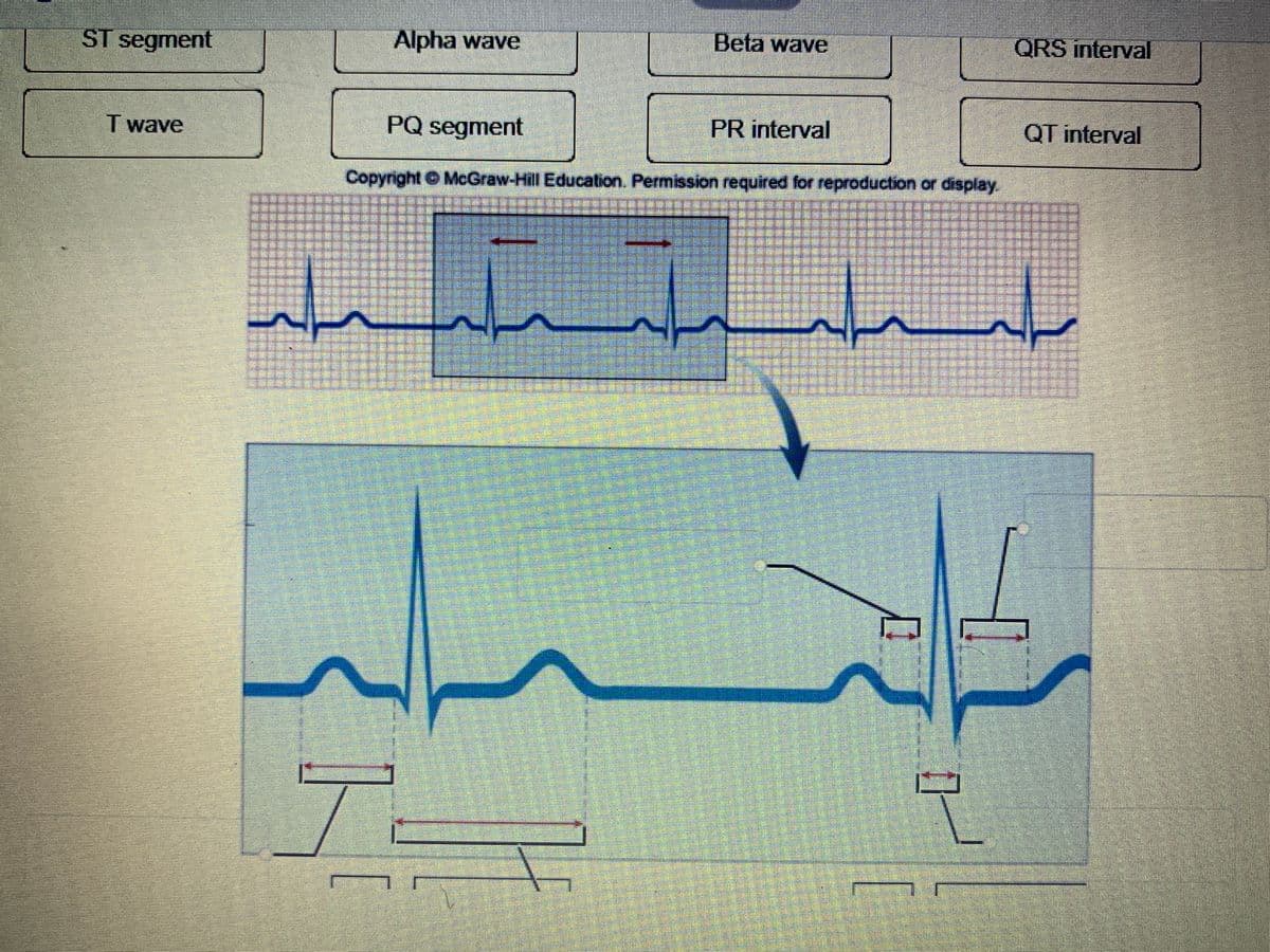 ST segment
Alpha wave
Beta wave
QRS interval
Twave
PQ segment
PR interval
QT interval
Copyright © McGraw-Hill Education. Permission required for reproduction or display.
