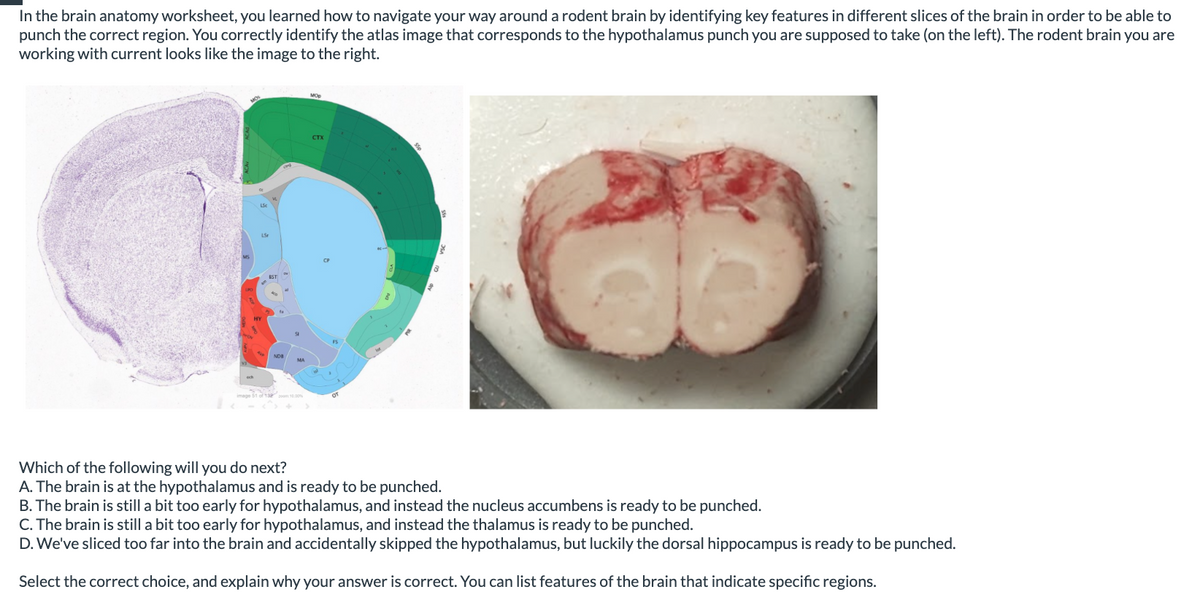 In the brain anatomy worksheet, you learned how to navigate your way around a rodent brain by identifying key features in different slices of the brain in order to be able to
punch the correct region. You correctly identify the atlas image that corresponds to the hypothalamus punch you are supposed to take (on the left). The rodent brain you are
working with current looks like the image to the right.
CTX
LS
D
Which of the following will you do next?
A. The brain is at the hypothalamus and is ready to be punched.
B. The brain is still a bit too early for hypothalamus, and instead the nucleus accumbens is ready to be punched.
C. The brain is still a bit too early for hypothalamus, and instead the thalamus is ready to be punched.
D. We've sliced too far into the brain and accidentally skipped the hypothalamus, but luckily the dorsal hippocampus is ready to be punched.
Select the correct choice, and explain why your answer is correct. You can list features of the brain that indicate specific regions.