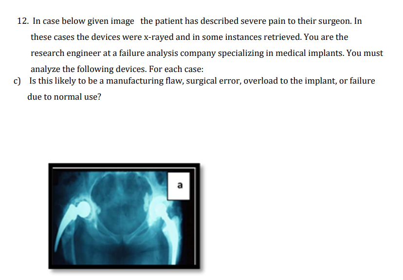12. In case below given image the patient has described severe pain to their surgeon. In
these cases the devices were x-rayed and in some instances retrieved. You are the
research engineer at a failure analysis company specializing in medical implants. You must
analyze the following devices. For each case:
c) Is this likely to be a manufacturing flaw, surgical error, overload to the implant, or failure
due to normal use?
a
