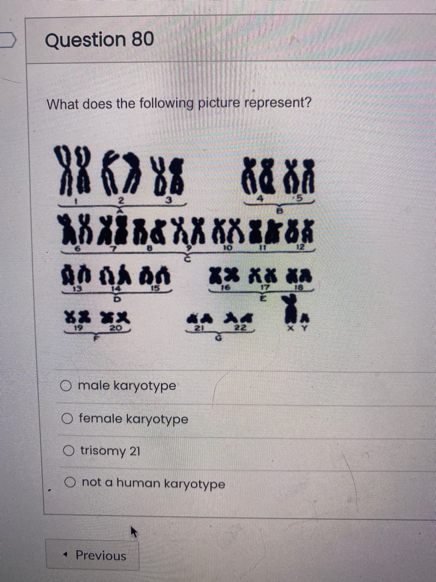 Question 80
What does the following picture represent?
XX (> 8% 88 XX
3
5
XXXXXXX
8
ᎣᎣ ᎣᎣ ᎣᎣ
13
15
14
D
XX XX
19
20
male karyotype
female karyotype
10
< Previous
KA AA
21
22
** ** **
16
17
18
E
trisomy 21
not a human karyotype
12