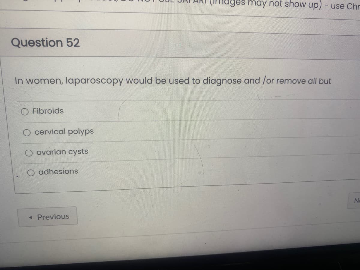 Question 52
In women, laparoscopy would be used to diagnose and /or remove all but
O Fibroids
O cervical polyps
ovarian cysts
adhesions
lages may not show up) - use Chr
<< Previous
Ne