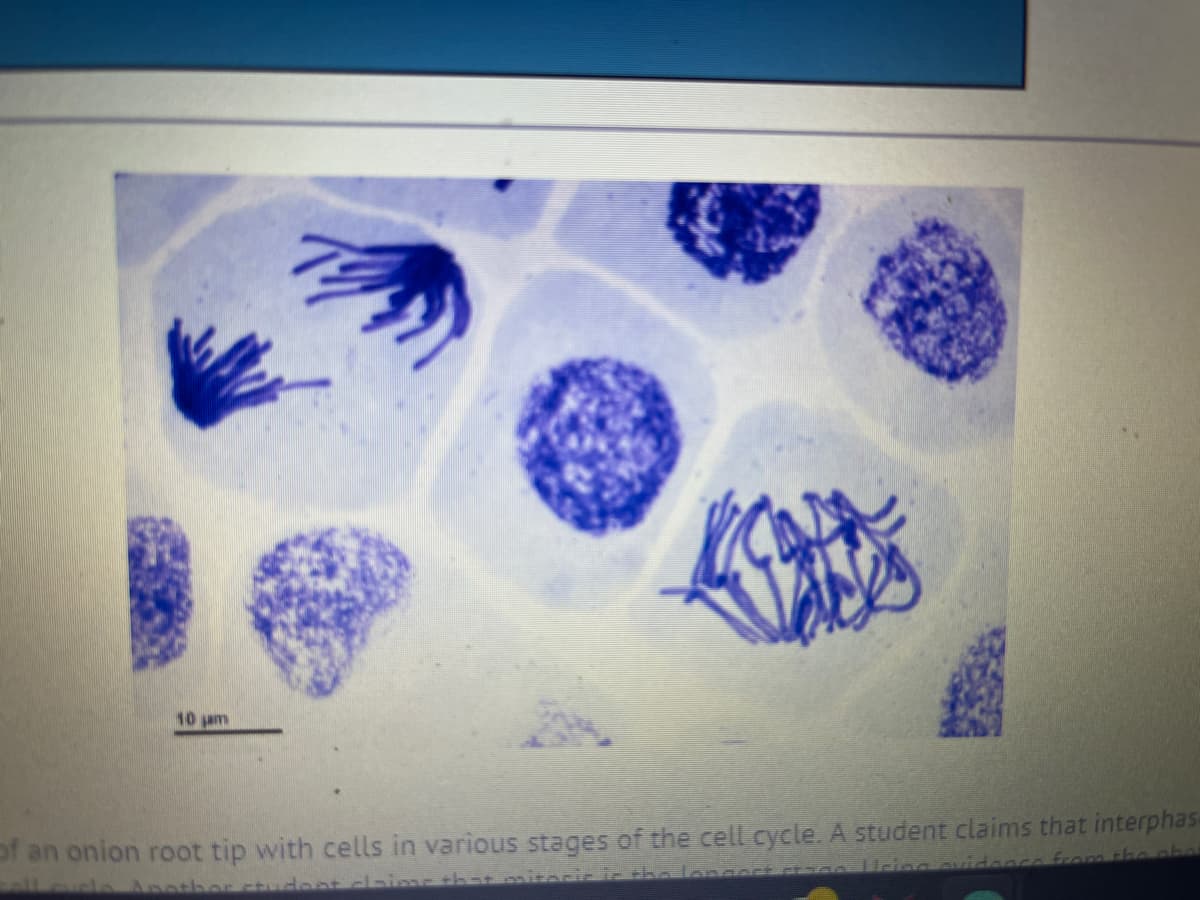 10 jam
of an onion root tip with cells in various stages of the cell cycle. A student claims that interphas-
dont claim that mitadic in the longest itago Ucing Cu
co from the pho