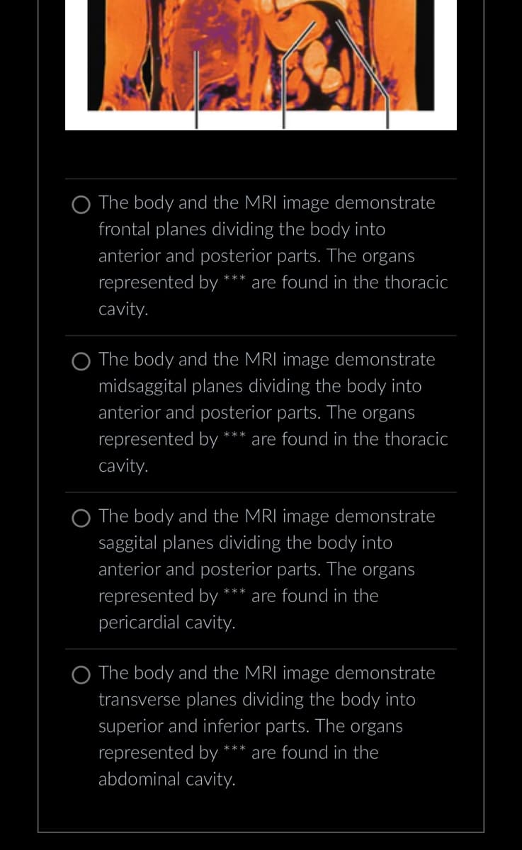 The body and the MRI image demonstrate
frontal planes dividing the body into
anterior and posterior parts. The organs
represented by *** are found in the thoracic
cavity.
The body and the MRI image demonstrate
midsaggital planes dividing the body into
anterior and posterior parts. The organs
represented by *** are found in the thoracic
cavity.
The body and the MRI image demonstrate
saggital planes dividing the body into
anterior and posterior parts. The organs
represented by *** are found in the
pericardial cavity.
The body and the MRI image demonstrate
transverse planes dividing the body into
superior and inferior parts. The organs
represented by are found in the
abdominal cavity.