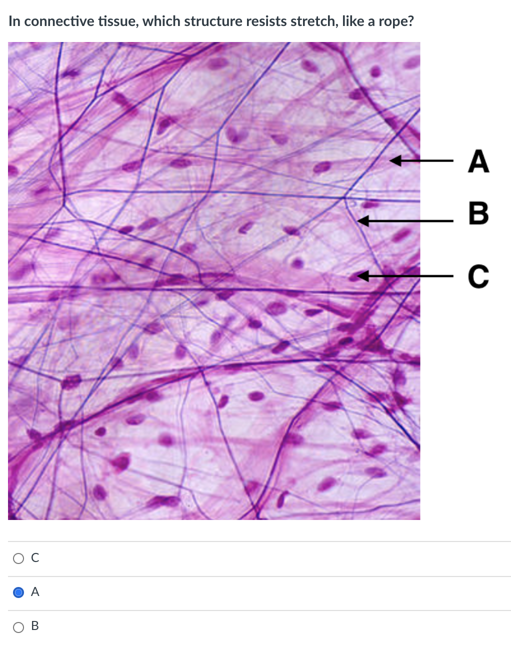 In connective tissue, which structure resists stretch, like a rope?
A
C
A
В
