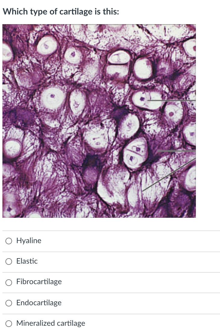 Which type of cartilage is this:
O Hyaline
Elastic
Fibrocartilage
O Endocartilage
Mineralized cartilage
