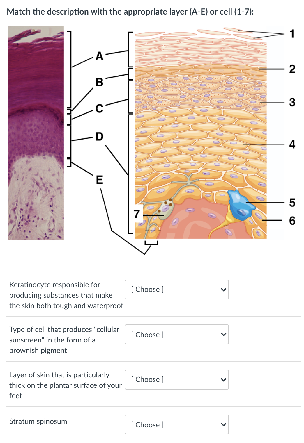 Match the description with the appropriate layer (A-E) or cell (1-7):
1
A
2
3
D
4
7
Keratinocyte responsible for
producing substances that make
the skin both tough and waterproof
[ Choose ]
Type of cell that produces "cellular
[ Choose ]
sunscreen" in the form of a
brownish pigment
Layer of skin that is particularly
[ Choose ]
thick on the plantar surface of your
feet
Stratum spinosum
[ Choose ]
LO
>
>
>
