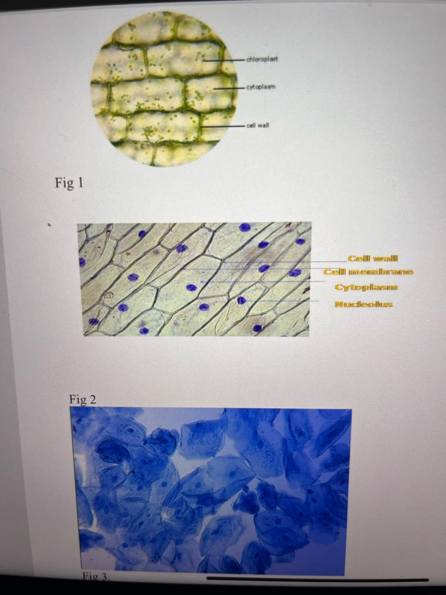 Fig 1
Fig 2
Fig 3.
chloroplast
cytoplasm
cell wall
Celll wall
Cellll membrane
Cytoplasm
Nucleolus