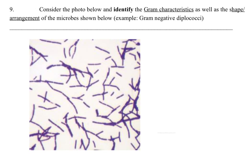 9.
Consider the photo below and identify the Gram characteristics as well as the shape/
arrangement of the microbes shown below (example: Gram negative diplococci)
