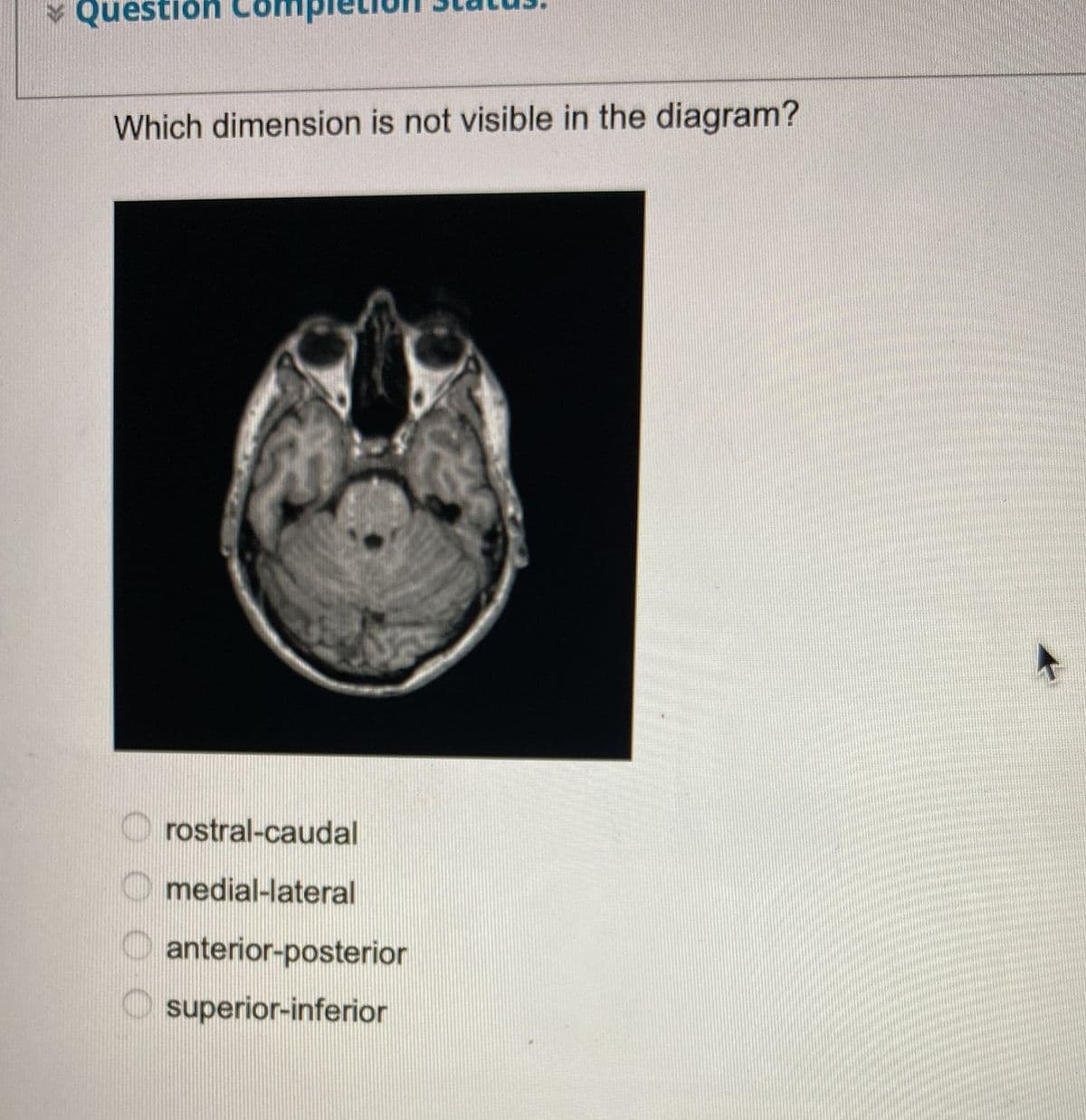 Question Co
Which dimension is not visible in the diagram?
rostral-caudal
medial-lateral
anterior-posterior
superior-inferior