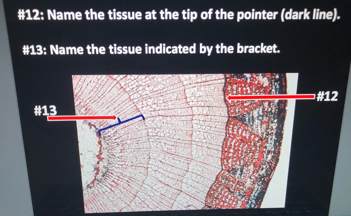 #12: Name the tissue at the tip of the pointer (dark line).
#13: Name the tissue indicated by the bracket.
#12
#13

