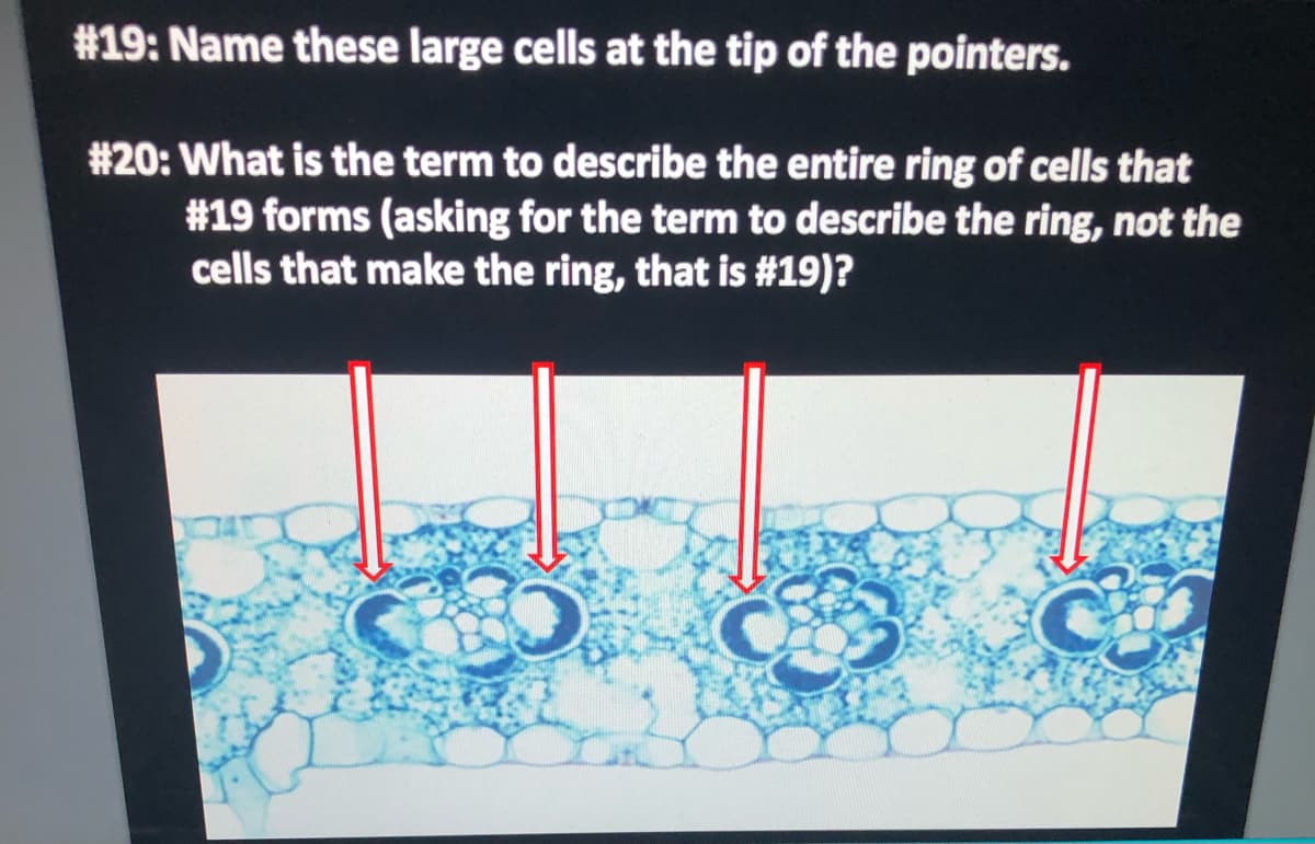 #19: Name these large cells at the tip of the pointers.
#20: What is the term to describe the entire ring of cells that
#19 forms (asking for the term to describe the ring, not the
cells that make the ring, that is #19)?
