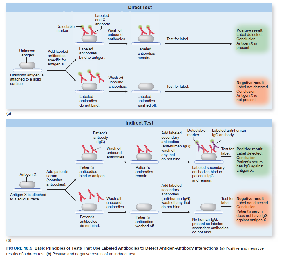 Direct Test
Labeled
anti-X
antibody
Detectable
marker
Wash off
Positive result
Label detected.
unbound
antibodies.
Test for label.
Conclusion:
Antigen X is
present.
Labeled
antibodies
bind to antigen.
Labeled
antibodies
remain.
Unknown
Add labeled
antigen
antibodies
specific for
antigen X.
Unknown antigen is
attached to a solid
surface.
Wash off
unbound
antibodies.
Negative result
Label not detected.
Test for label.
Labeled
antibodies
do not bind.
Labeled
antibodies
washed off.
Conclusion:
Antigen X is
not present
(a)
Indirect Test
Detectable
marker
Labeled anti-human
Patient's
Add labeled
IgG antibody
antibody
(IgG)
secondary
antibodies
(anti-human IgG);
wash off
any that
do not bind.
Wash off
unbound
Test for Positive result
Label detected.
Conclusion:
Patient's serum
has IgG against
antigen X.
label,
antibodies.
Patient's
antibodies
bind to antigen.
Patient's
antibodies
remain.
Labeled secondary
antibodies bind to
patient's IgG
and remain.
Add patient's
Antigen X
serum
(contains
antibodies).
Add labeled
secondary
antibodies
(anti-human IgG);
wash off any that
do not bind.
Antigen X is attached
to a solid surface.
Wash off
unbound
antibodies.
Test for Negative result
label.
Label not detected.
Conclusion:
Patient's serum
does not have IgG
against antigen X.
Patient's
antibodies
do not bind.
Patient's
antibodies
washed off.
No human IgG,
present so labeled
secondary antibodies
do not bind.
(b)
FIGURE 18.5 Basic Principles of Tests That Use Labeled Antibodies to Detect Antigen-Antibody Interactions (a) Positive and negative
results of a direct test. (b) Positive and negative results of an indirect test.
