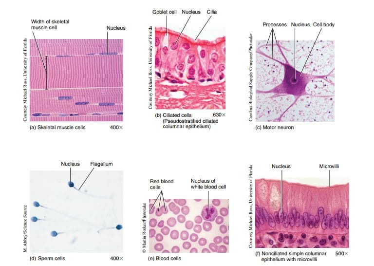 Goblet cell Nucleus Cilia
Width of skeletal
muscle cell
Processes Nucleus Cell body
Nucleus
630x
(b) Ciliated cells
(Pseudostratified ciliated
columnar epithelium)
(a) Skeletal muscle cells
(C) Motor neuron
400x
Nucleus
Flagellum
Nucleus
Microvilli
Red blood
Nucleus of
cells
white blood cell
(1) Nonciliated simple columnar
epithelium with microvilli
500x
(d) Sperm cells
400x
(e) Blood cells
M. Abbey/Science Source
Courtesy Michael Ross, University of Florida
O Martin Rotker/Phokotake
Courte sy Michael Ross, University of Florida
Courtesy Michael Ross, University of Florida
Carolina Biokogical Supply Company/Phototake
