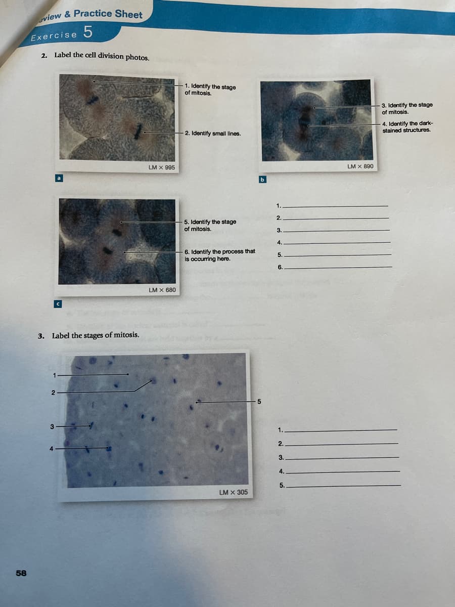 view & Practice Sheet
Exercise 5
2. Label the cell division photos.
1. Identify the stage
of mitosis.
3. Identify the stage
of mitosis.
4. Identify the dark-
stained structures.
2. Identify small lines.
LM X 995
LM x 890
1.
2.
5. Identify the stage
of mitosis.
3.
4.
6. Identify the process that
is occuring here.
5.
6.
LM x 680
3. Label the stages of mitosis.
1.
2.
3.
4.
5.
LM x 305
58
