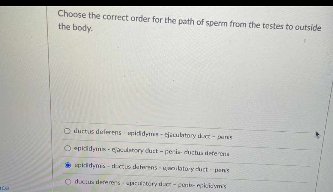 ace
Choose the correct order for the path of sperm from the testes to outside
the body.
O ductus deferens - epididymis- ejaculatory duct - penis
O epididymis- ejaculatory duct - penis- ductus deferens
O epididymis- ductus deferens - ejaculatory duct - penis
ductus deferens - ejaculatory duct - penis- epididymis