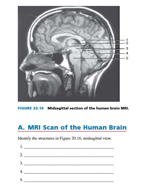 FIGURE 20.16 Midsagittal section of the human brain MRI.
A. MRI Scan of the Human Brain
Identify the structures in Figure 20.16, midsagittal view.
1.
2.
3.
4.
5.
1234L
