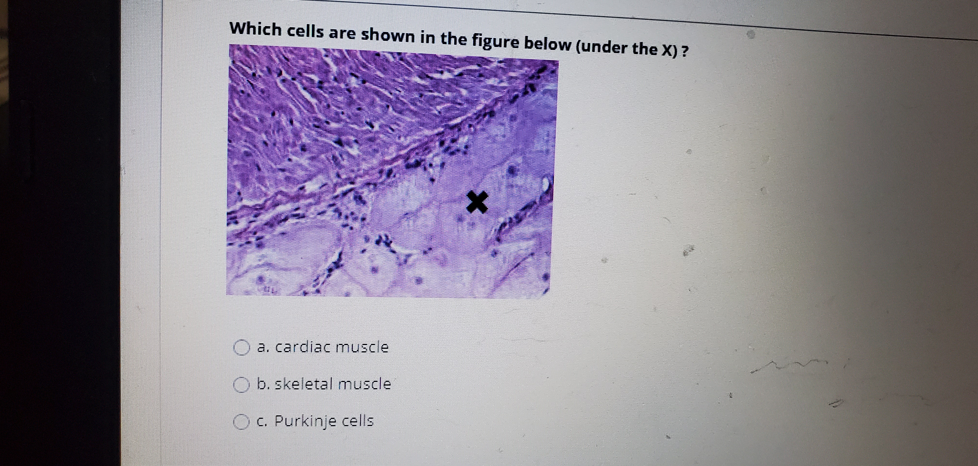 Which cells are shown in the figure below (under the X) ?
